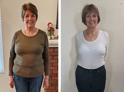 Before-and-after photos of Margaret