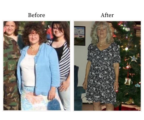 Mary Jo's Before and After Photo