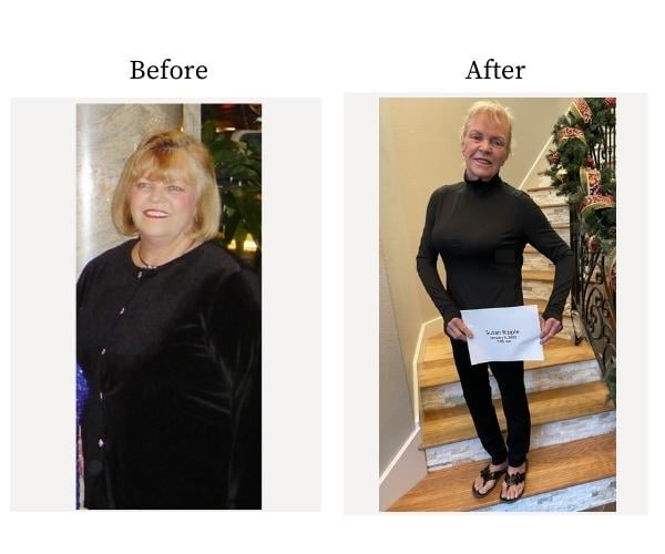 Susan's Before and After Photo