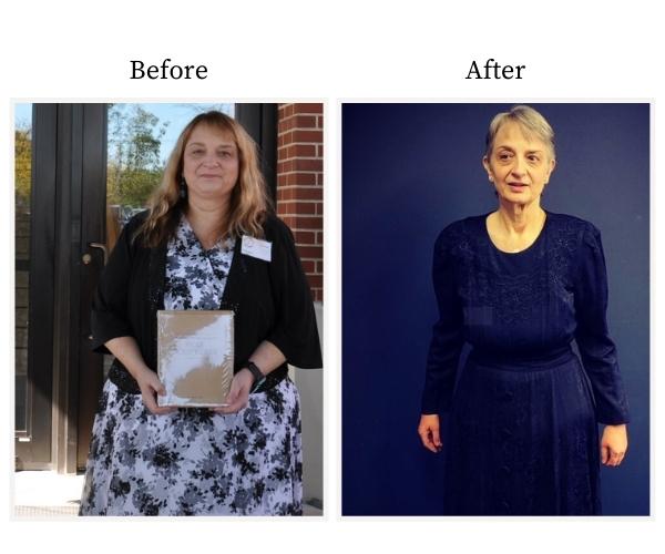 Susann's Before and After Photo